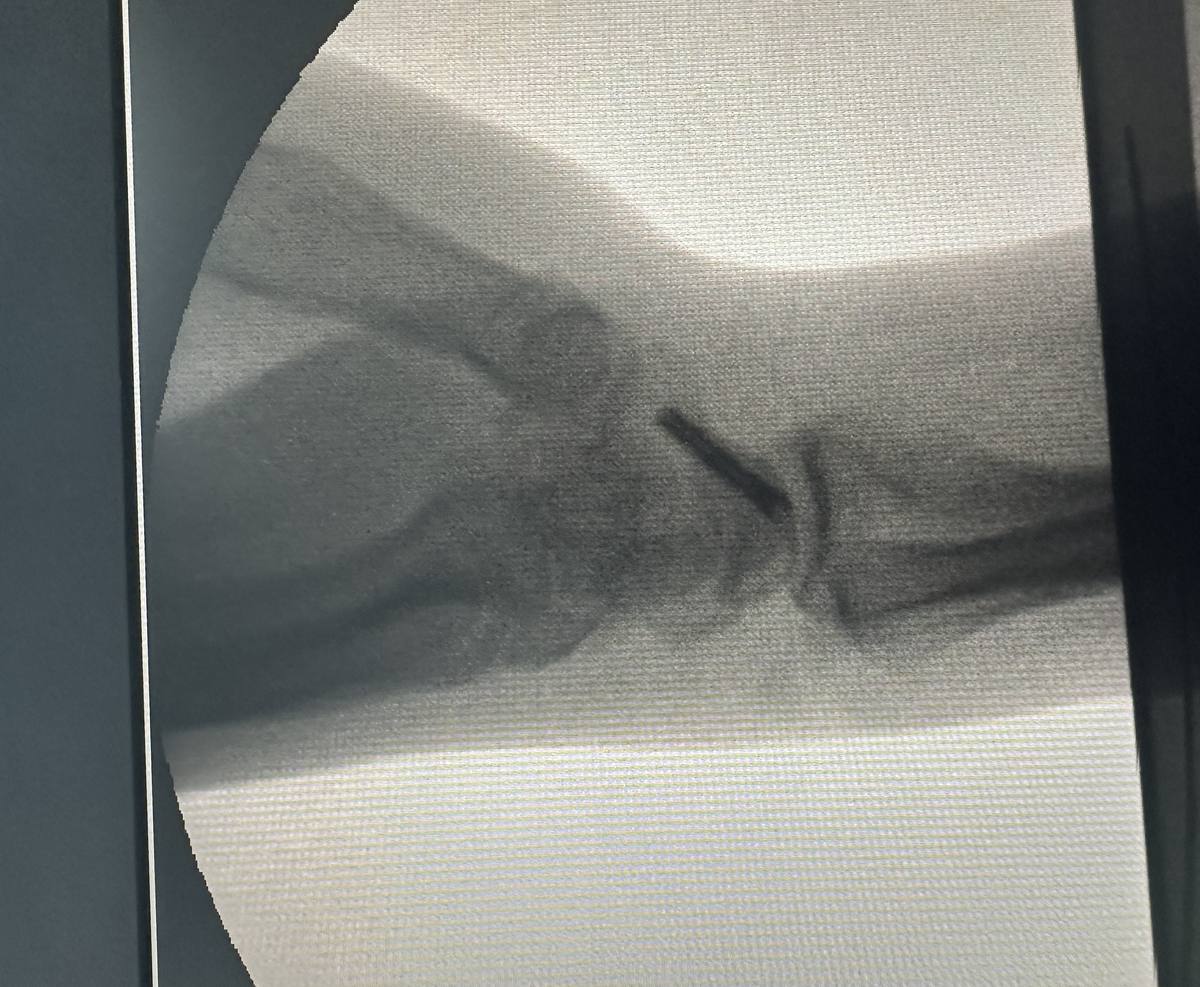 X-ray